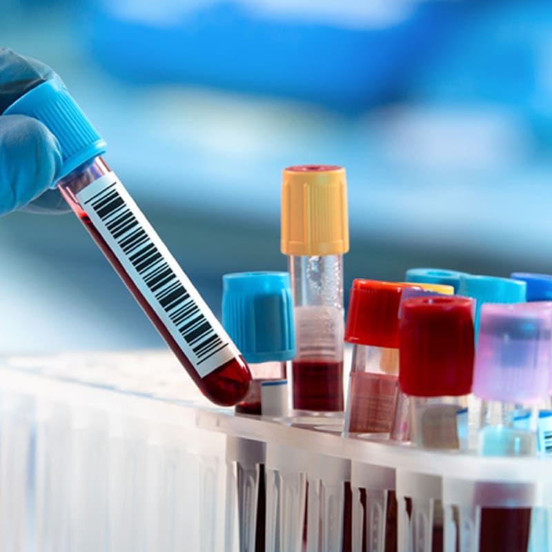 Golden Horizon Lab Tests
