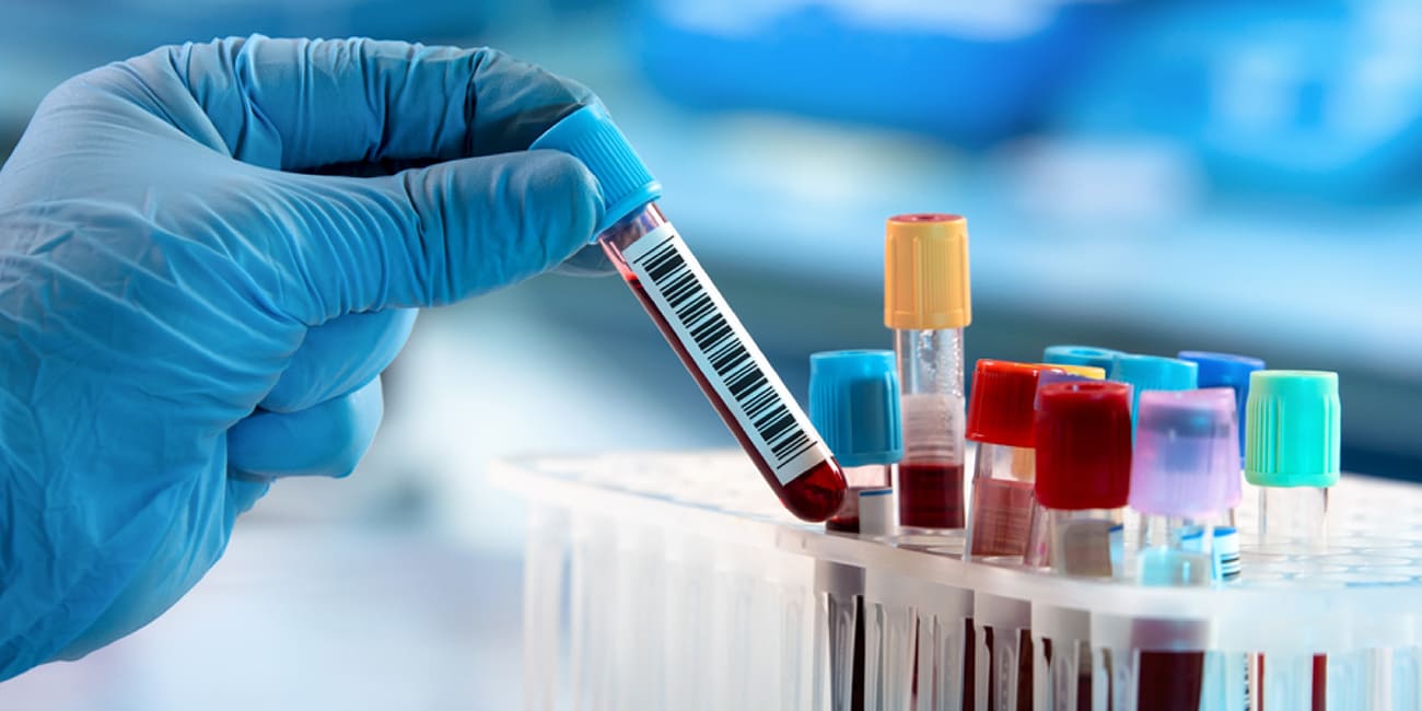 Golden Horizon Lab Tests